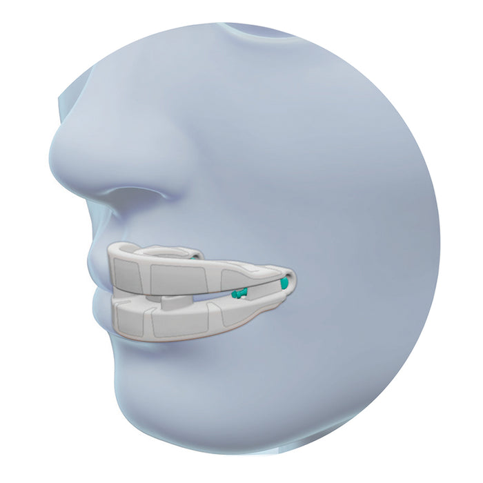SnoreLogic Anti-Snoring Mouthpiece